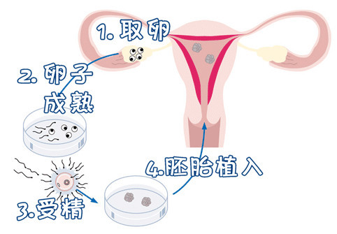 关于景泰生殖